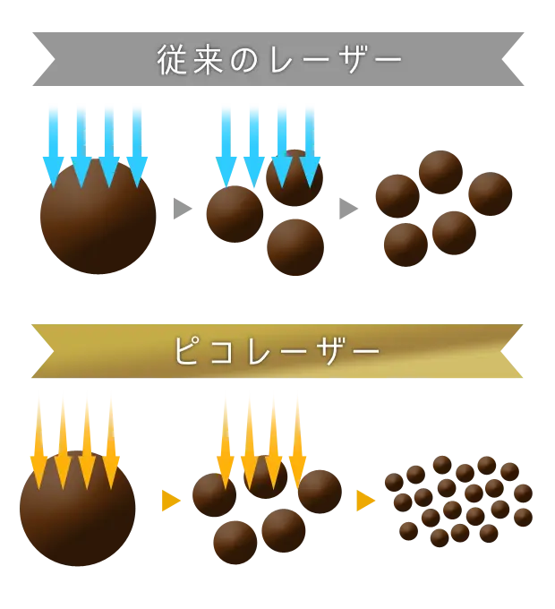 ピコレーザーの仕組み